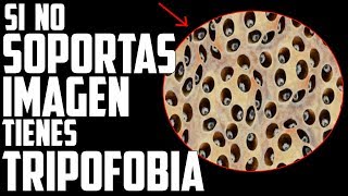 ¿Tienes Tripofobia?