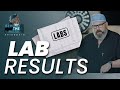 Preop understanding your lab results