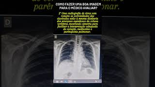 Aprenda quando uma radiografia de tórax está ideal para enviar para o médico.