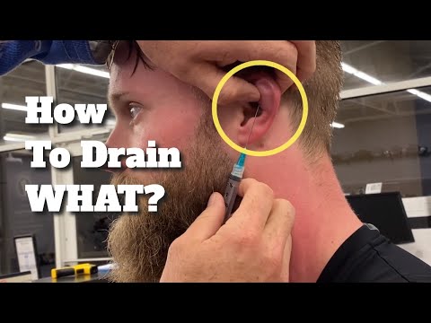 BJJ For Beginners: How to Drain Cauliflower Ear