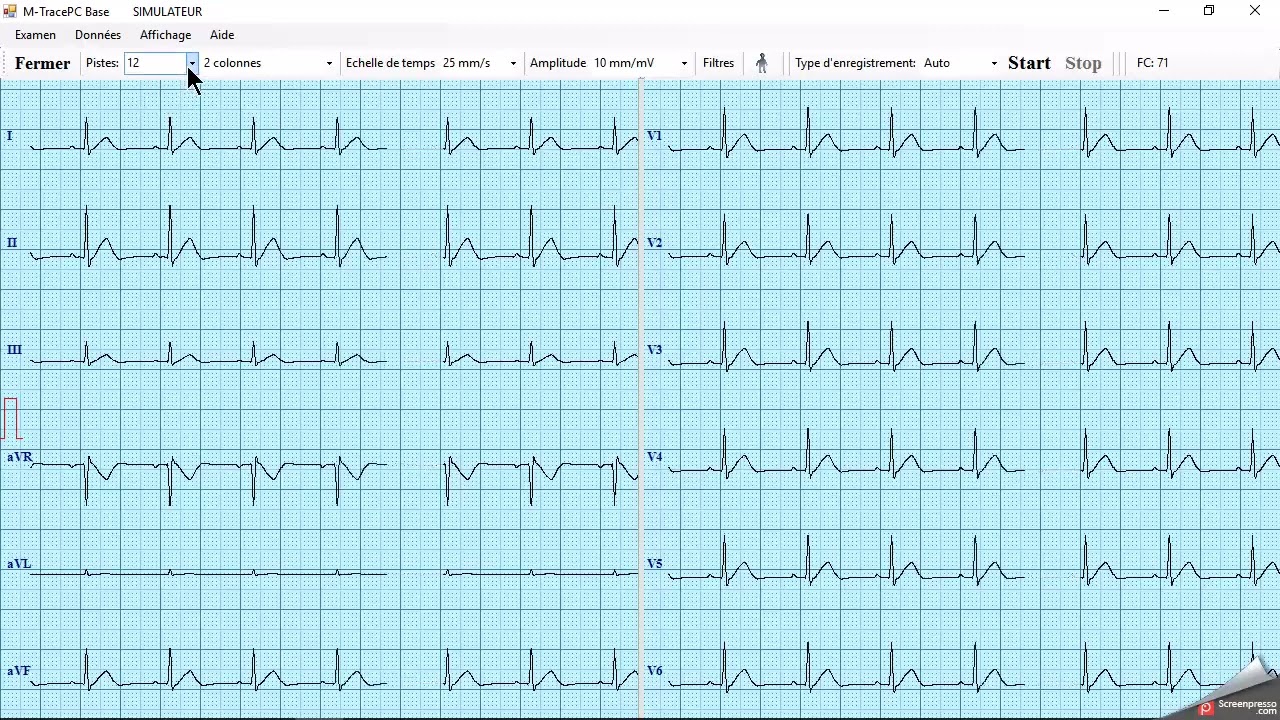 imprimante A4 laser pour ECG EOLYS