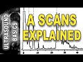 ultrasound - A scans explained