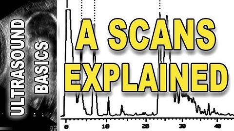 ultrasound - A scans explained