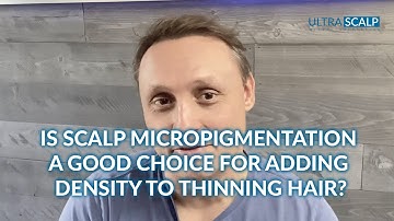 Can I Keep My Hair?  Scalp Micropigmenation (Hair Tattoo) For Density - Tampa, Florida