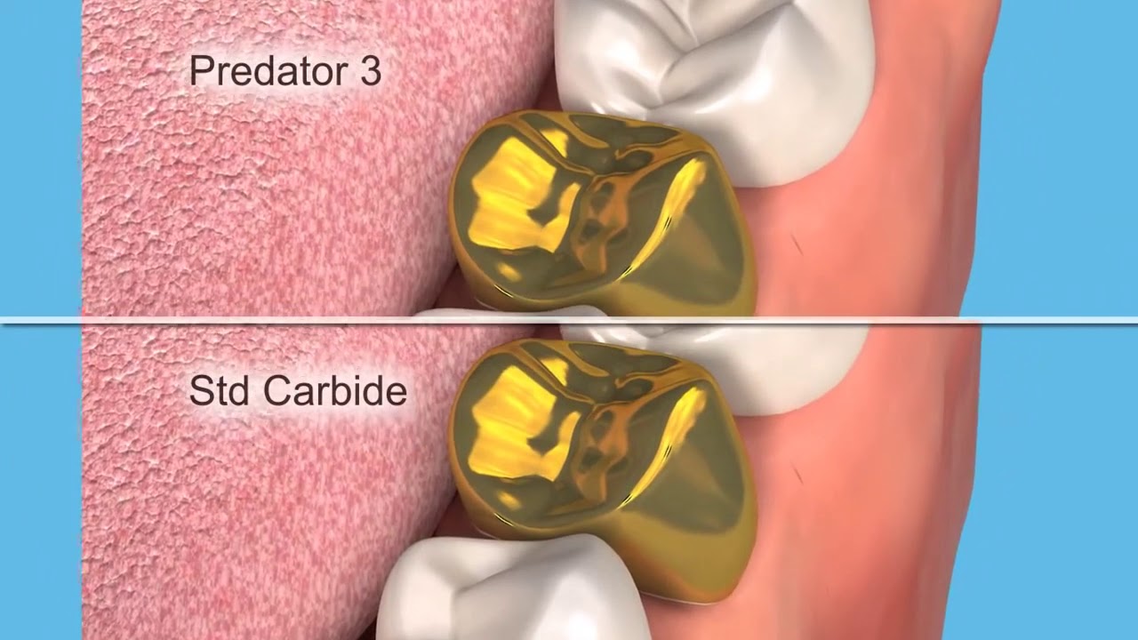 Product Description Predator 3T Crown Removal Burs YouTube