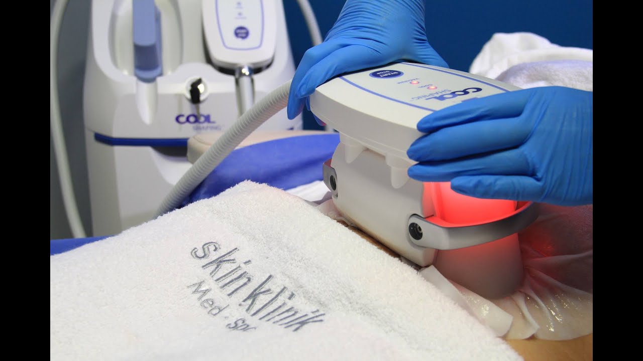 Eliminación de la grasa sin cirugía Coolshaping - YouTube