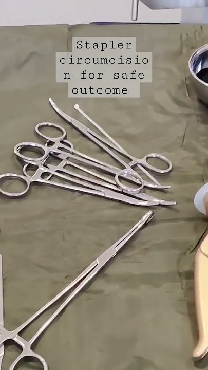 Best circumcision surgery with stapler a day care procedure for safe outcome. #circumcision