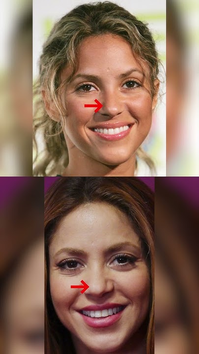 Did Shakira Have a Nose Job? - YouTube