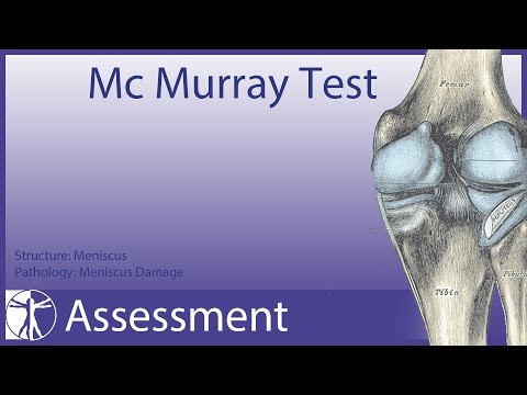 McMurray Test |