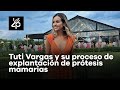 Tuti Vargas y su experiencia con la explantación de prótesis mamarias