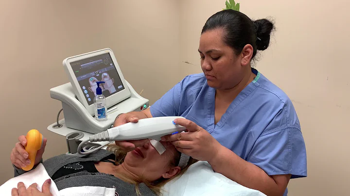 Ultherapy Skin Tightening - Facial Rejuvenation - ...