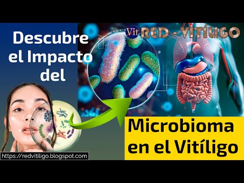 Vitiligo y Microbioma: