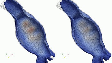 Inverse analysis of an abdominal aortic aneurysm model (AAA) - predicted displacements