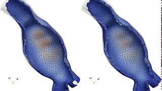 Inverse analysis of an abdominal aortic aneurysm model (AAA) - predicted displacements
