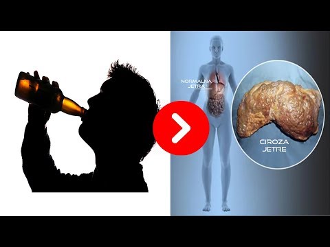 Video: Kako Ukloniti Alkohol Iz Tijela