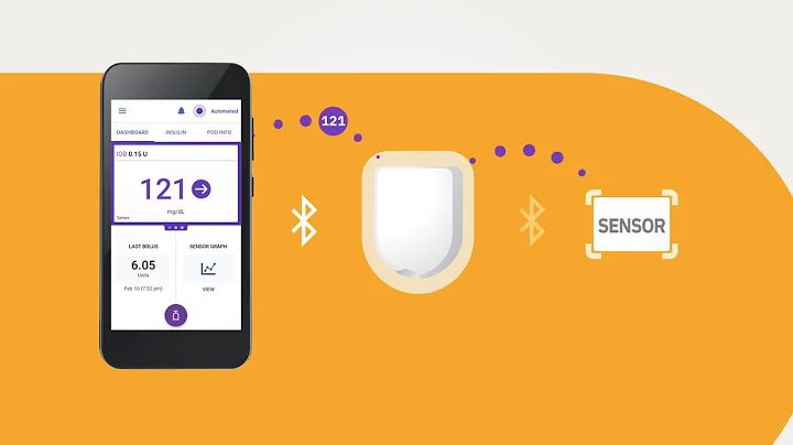 Omnipod® 5 Automated Insulin Delivery System Product Training - Overview