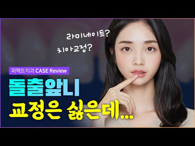 돌출앞니 교정은 싫은데... 최소삭제 라미네이트 가능할까❓ (feat.변색, 치아 사이 공간)