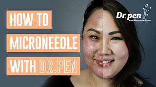 How To Microneedle At Home With Dr Pen Dr Pen Australia Microneedling Skin Needling Cit