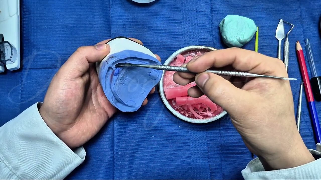 Elaboración de placa base para prostodoncia total de alta succión (Tutorial completo)
