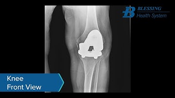Blessing Health System | Dynamic Digital Radiography (DDR) Scans