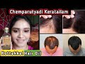 தமிழில் Kottakkal Chemparutyadi Keratailam Review || Hair growth Treatment || Seborrheic dermatitis