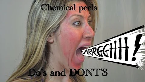 Chemical Peels | Do's And Dont's