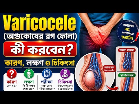 Varicocele: Causes, Symptoms & Treatment