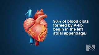 Watchman Procedure for Left Atrial Appendage Occlusion (LAAO)