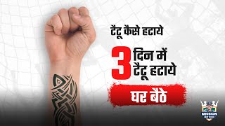 टट क हटन क जबरदसत तरक क बर म जन tattoo hatane ka tarika    cool thoughts