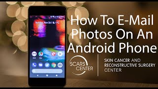 How To Email Photos With Your ANDROID PHONE || Telehealth Appointments with SCARS Center