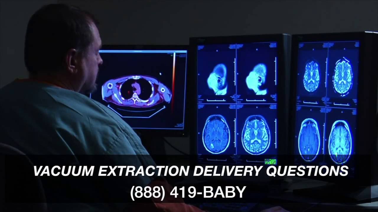 Vaccuum Extraction Delivery and Birth Injury YouTube