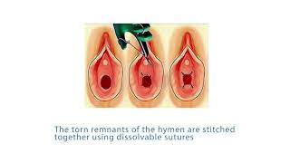 World Health Organization Who On Twitter Performing Virginitytesting Violates Several Human Rights And Ethical Standards Including The Fundamental Principle In Medicine To Do No Harm Virginity Testing Must End Https T Co Mqntknovdb Endvaw