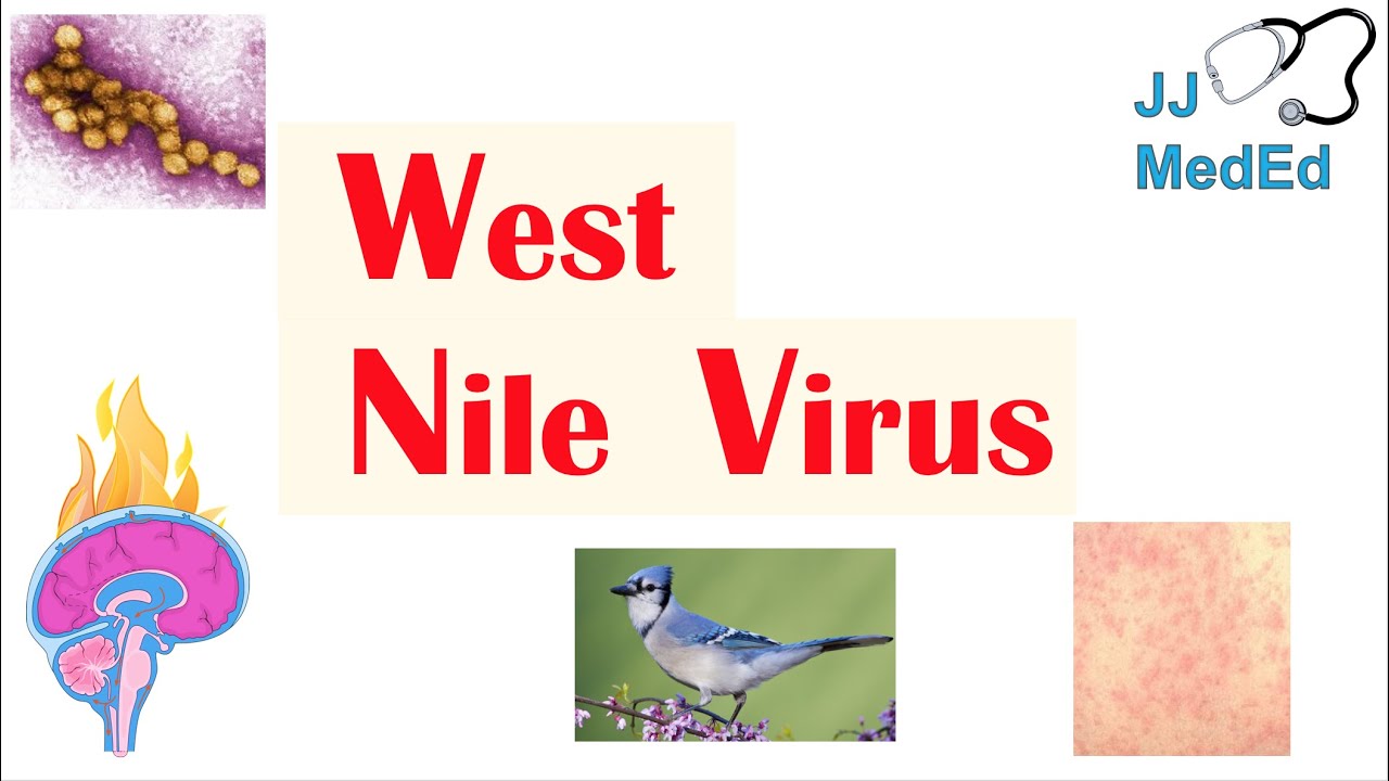 West Nile Virus West Nile Encephalitis Pathogenesis Symptoms Diagnosis and Treatment