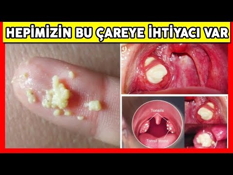 Video: Bir cümlede daha kötü ve daha kötü nasıl kullanılır?