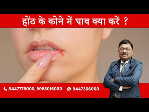 होठों के कोने में घाव नहीं भरता: क्या करें? | डॉ. बिमल छाजेर द्वारा | साओली