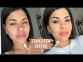 FOUNDATION ROUTINE For Acne & Dry Skin Patches