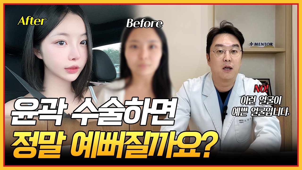 얼굴 윤곽 수술 하면 정말 예뻐질까요? 이것만 알면 성공한다‼️
