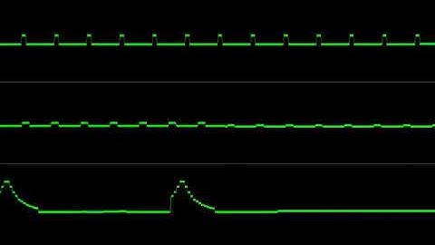 [Atari ST] Jochen Hippel - Buzzer (Oscilloscope View) (Improved)