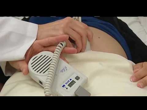 Video: Ultragarso Diagnostika Nėštumo Metu: Galimos Pasekmės Vaisiui