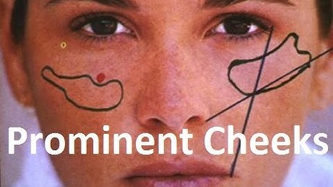 Importance of Prominent Cheeks in Facial Beauty by Prof John Mew