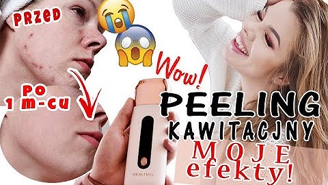 TO NIE FEJK! PEELING KAWITACYJNY Jak używać? Co daje? Czy warto? Efekty po miesiącu!