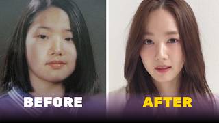 Mengapa Operasi Plastik Begitu Umum di Korea Selatan?