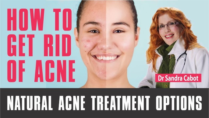 5 Ways To Effective Acne Treatment Options And 2024