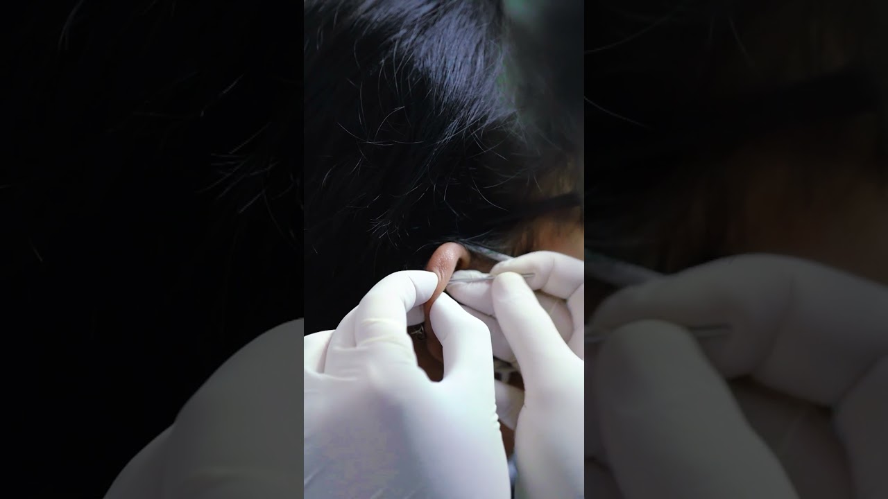 Tindik Telinga Flat Piercing = IDR 200K @piercingindonesia