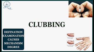 Clubbing | medicine practical | NEXT PG