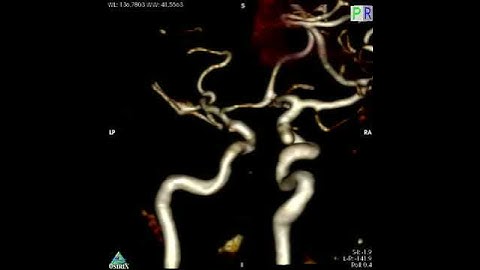 Volume rendering on 3d TOF