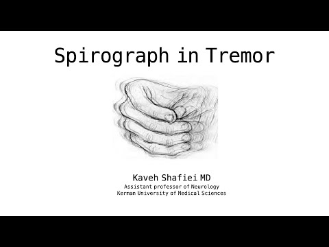 Spiral drawing in Tremor