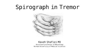 Spiral drawing in Tremor