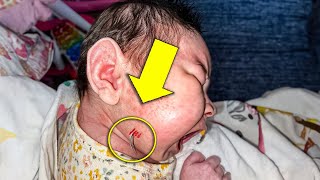 Mother Spots a Stick Growing Out of her Baby's Face, Doctors Were Shocked To Find This..