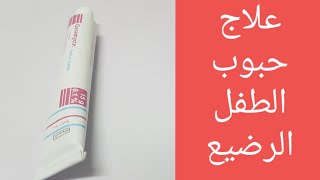 علاج حبوب الوجه عند الطفل الرضيع